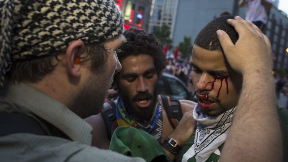 A bleeding anti-NATO protestor is comforted after a scuffle with police during a march in Chicago. (AP Photo/John Minchillo)