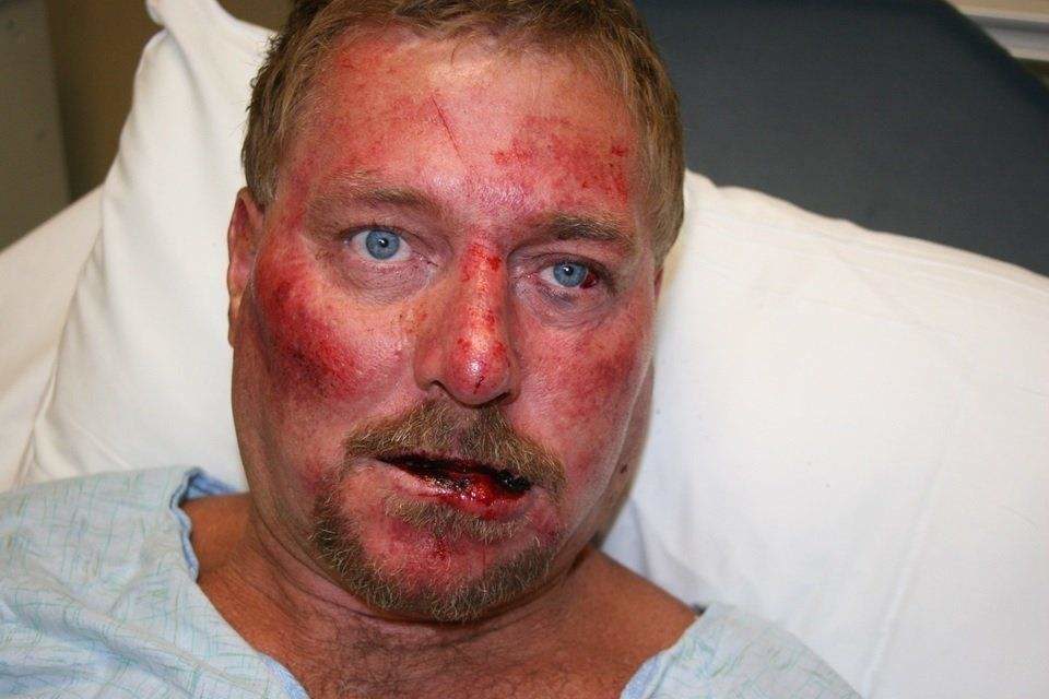 Crime scene photo of Robert Bryant at Huntsville Hospital following arrest on Aug. 22, 2012. (Photo by Madison County Sheriff's Department)