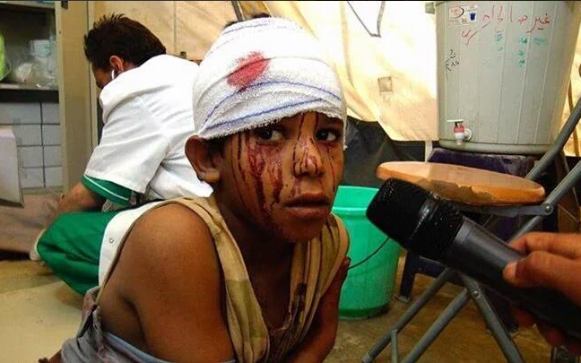 Ten children were killed and 28 injured, according to MSF