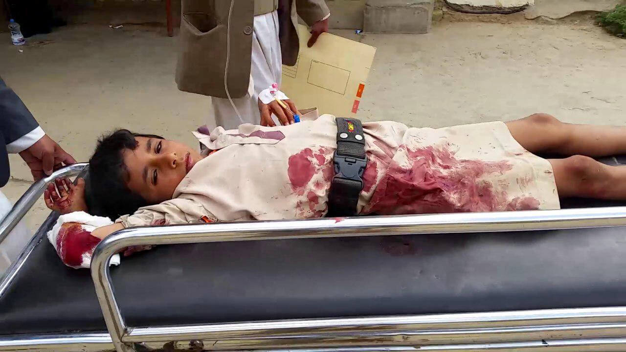A child who was wounded in a Saudi airstrike on a home in Yacbur in  Dhakhieah district of  Sadaa on Friday, July 29, 2018. Photo | MintPress