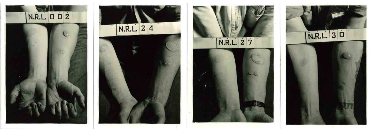 Human Medical experiments