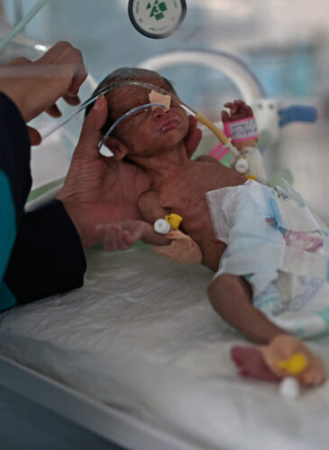 Yemen Aid Feature photo