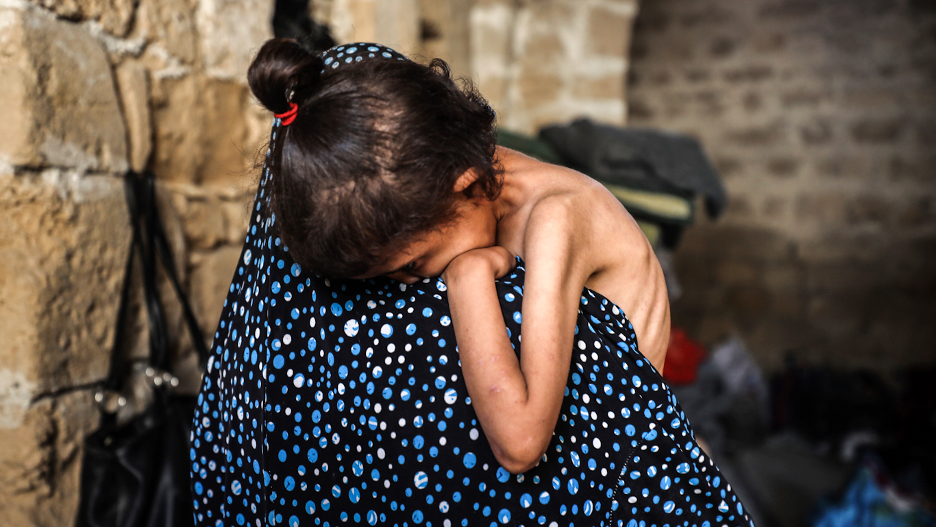 Malnourished Palestinian child held by mother in Gaza shelter during famine, May 2025